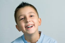 early orthodontic treatment in Silver Spring Maryland