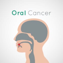 Oral Cancer Awareness Month Silver Spring MD